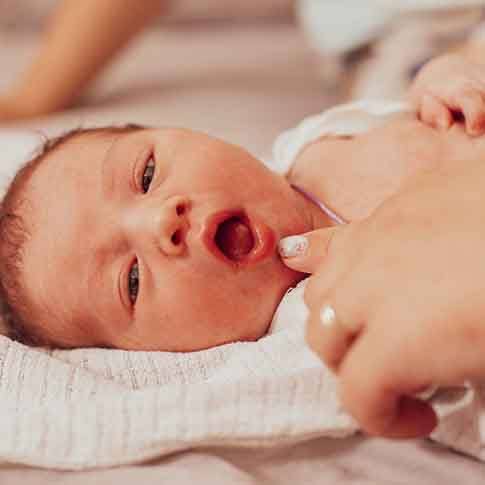 a baby smiling during an oral exam