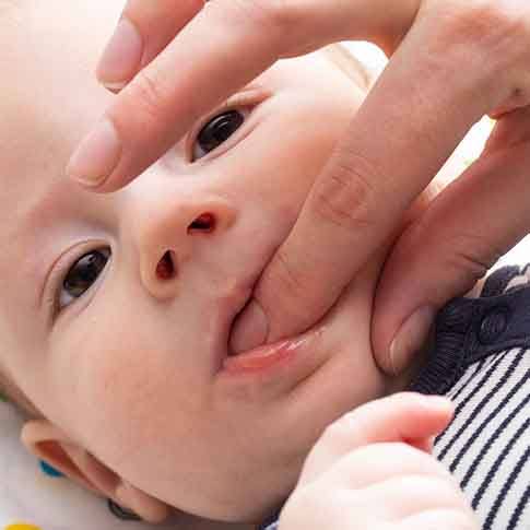 an infant during an oral examination